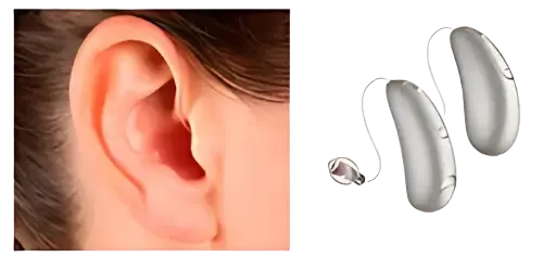 aparelho auditivo - modelo (RIC)